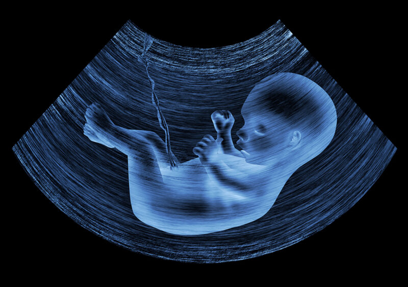 Embryo